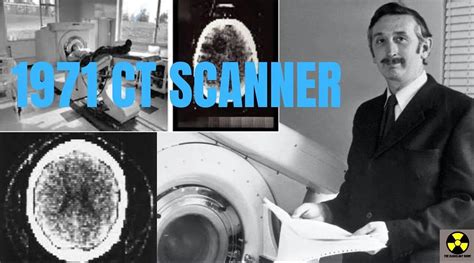 The 1971 CT Scanner