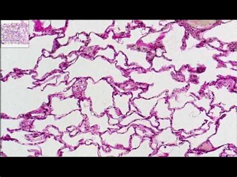 Simple Squamous Epithelium Slide