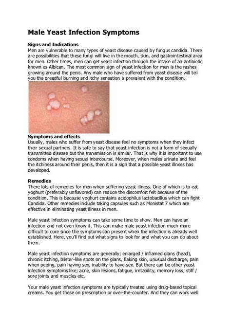 Male yeast infection symptoms