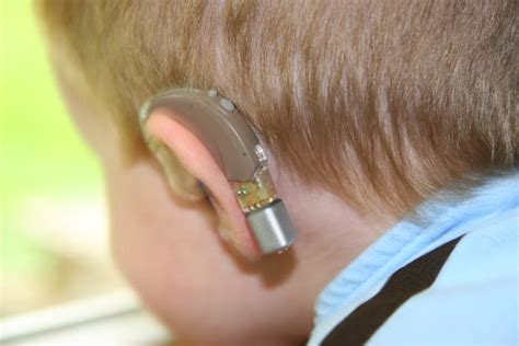 Hearing Loss and Assistive Listening Devices - HubPages