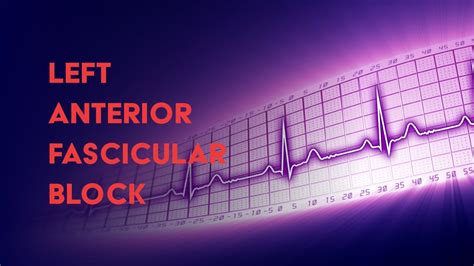 Left Anterior Fascicular Block Meaning In Tamil - malaynesra