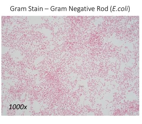 3-7: The Gram Stain, 3-10: Endospore Stain, 3-8: Acid Fast Stain, 3-9 ...