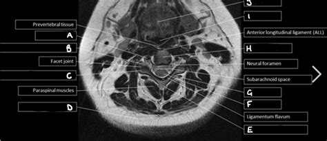 MRI Axial View 2 Diagram | Quizlet