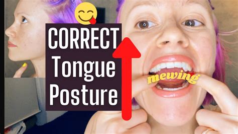 Mewing Tongue Posture Diagram