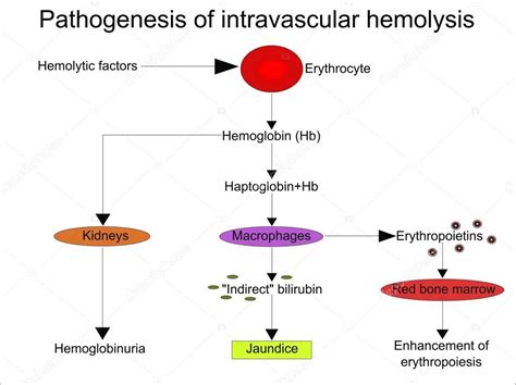 Pathogenèse de l'hémolyse intravasculaire Vecteur par ©sandro_ 105261432