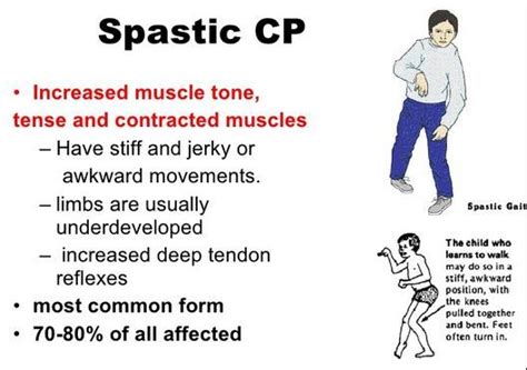 What is Spastic Diplegia Cerebral Palsy? More Cerebral Palsy Awareness ...