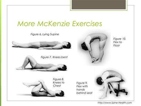 More McKenzie Exercises Figure 6. Lying Supine Figure 10. Flex to Floor ...