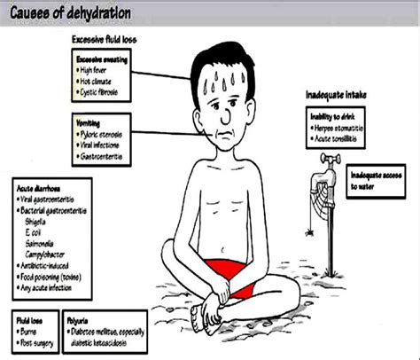 Dehydration - Causes, Symptoms, Treatment, Diagnosis and Prevention ...