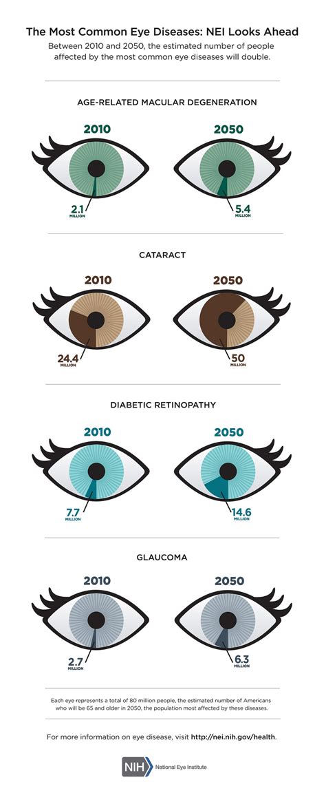 Common Eye Disease by NIH 11.10.15 - Discovery Eye Foundation