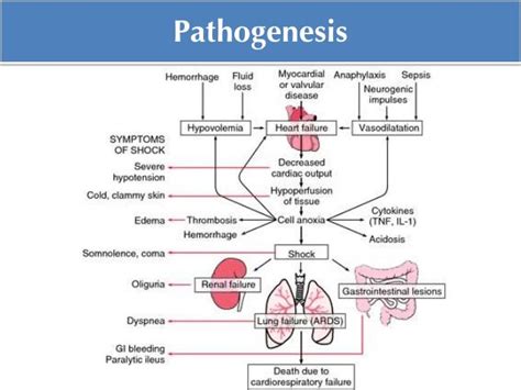 Hemorrhagic Shock