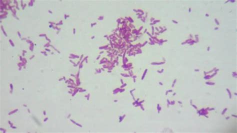 Escherichia coli bacteria (E. coli) under microscope, magnification ...