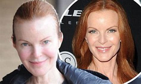 Marcia Cross Plastic Surgery Before And After