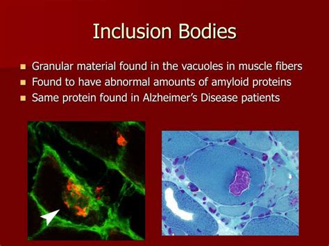 PPT - Inclusion Body Myositis PowerPoint Presentation - ID:4073591