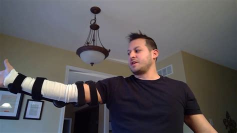 Distal Bicep Tendon Rupture Surgery Update - YouTube