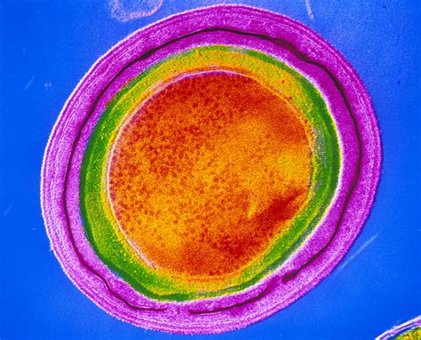 Clostridium Tetani Bacterial Spore Photograph by Cnri