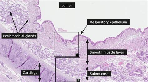 Dictionary - Normal: Bronchus | Teaching biology, Medical school ...