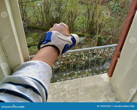 Sprained Thumb in Medical Splint Stock Image - Image of open, medical ...