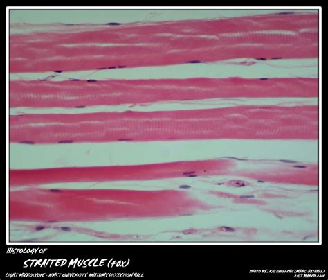 Histology: Striated Muscle | My Aimst University Lifestyle Blog