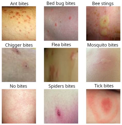 Tick bite identification - serydesigners