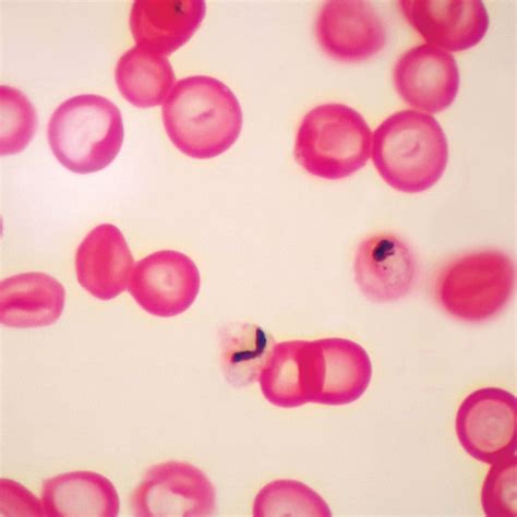 Plasmodium falciparum Slide, Smear | Carolina Biological Supply