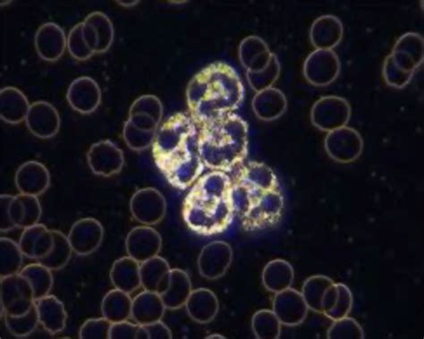 Dark Field Microscopy - Live Blood Online