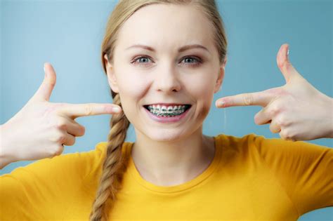 Blue Braces: How To Pick the Right Colors for Your Braces - Blue Ridge ...