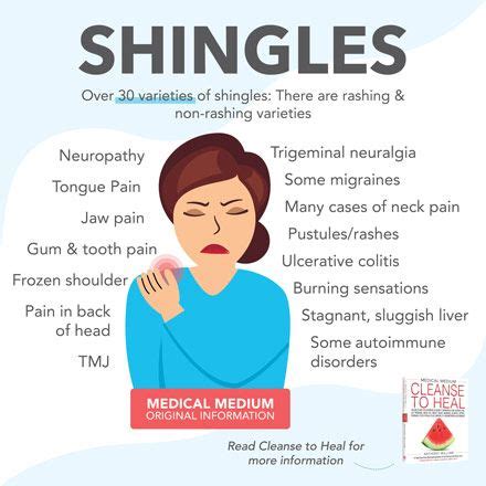 Shingles | Medical medium, Medical, Tooth pain