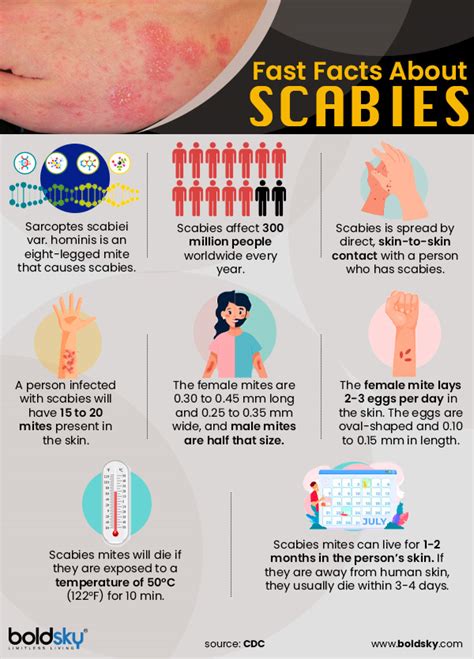 Scabies Symptoms And Treatment | Images and Photos finder