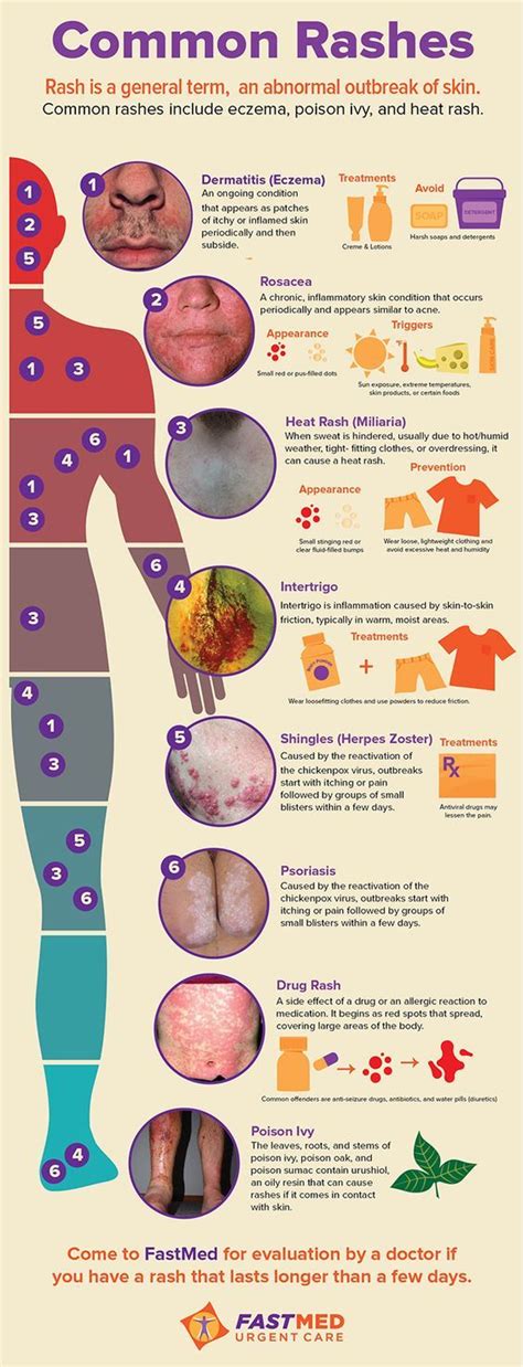 Common Rashes #skin #itch #rash | Medical education, Nursing school, Nurse