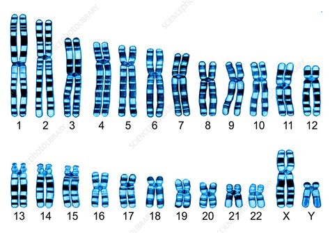 Human Karyotype - Stock Image - C013/0006 - Science Photo Library