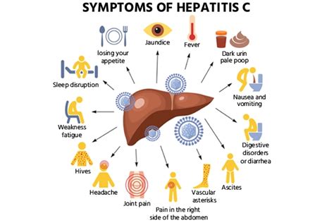 Hepatitis C: Causes, Symptoms, Treatment & Diagnosis