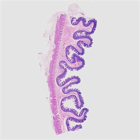 Microscope Sample Slides Typical Histology Slides Muscle Histology ...