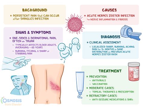 Postherpetic Neuralgia: What Is It, Causes, Symptoms, and More | Osmosis