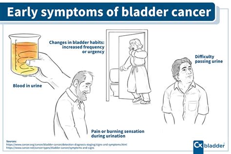 What Are the First Signs & Symptoms of Bladder Cancer? | Cxbladder