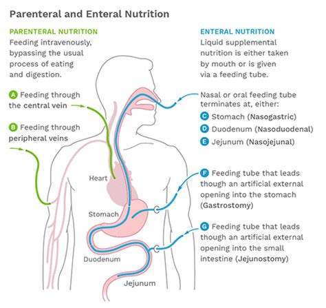 Types of enteral feeding