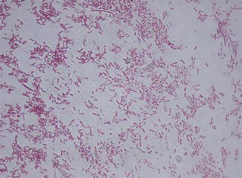 What is Pseudomonas Bacteria? Characteristics, Gram stain & Infection