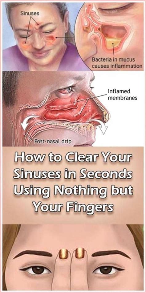 Diy: How To Clear Your Sinuses In Seconds Using Nothing But Your ...