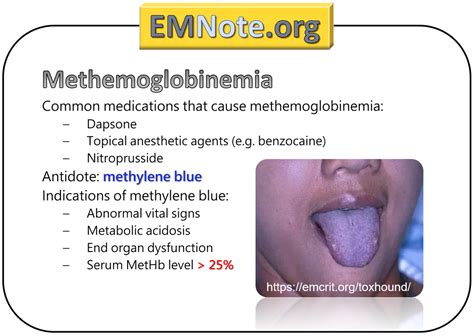 EMNote.org - EMNote