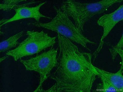 Caspase 3 Antibody (19677-1-AP)