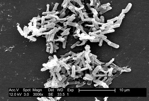 Clostridium | Bacteria, Characteristics, & Infection | Britannica