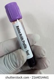 Blood Sample Amino Acids Profile Test Stock Photo 2164014461 | Shutterstock