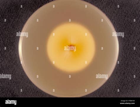 Sabouraud dextrose agar hi-res stock photography and images - Alamy