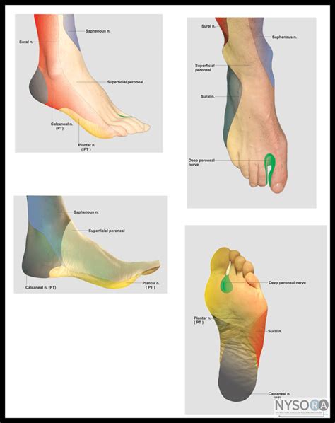 The New York School of Regional Anesthesia - Ankle Block | Nerve ...