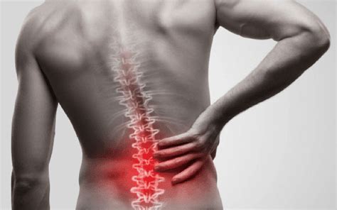 Lower Back Pain Due To Spinal Arthritis Non-Surgical Pain Management ...