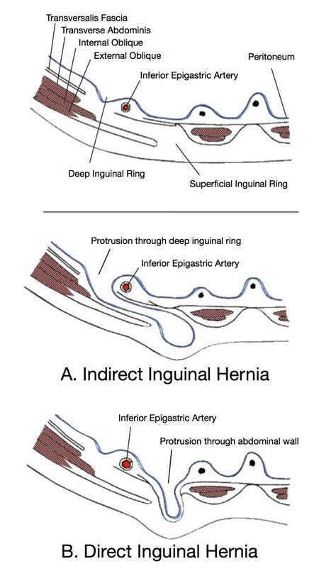 Pin on CMAJ medical illustrations & art