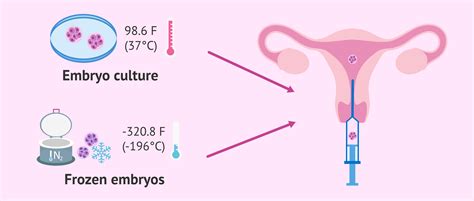 Frozen Embryo Transfer Implantation Timeline