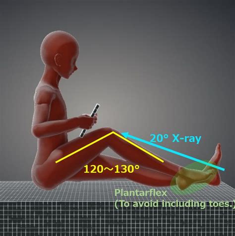 Knee joint axial view, sunrise view, skyline view, Laurin view｜Tools ...