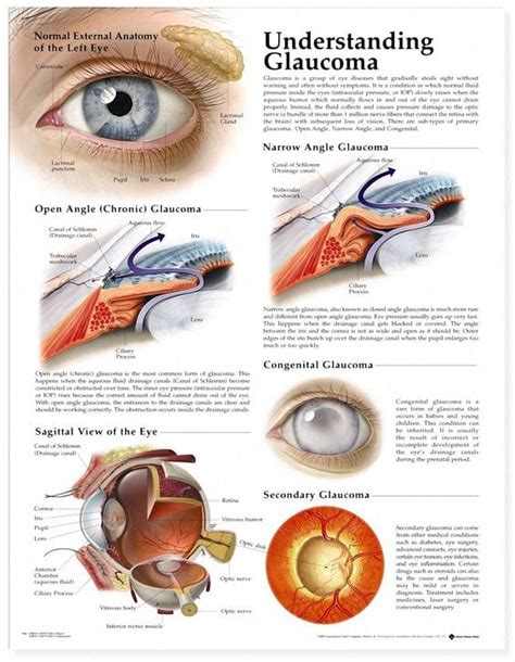 Glaucoma Treatment Options in Amherst, MA and Florence, MA