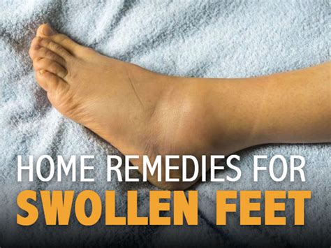 12 Effective Home Remedies For Swollen Feet - Boldsky.com