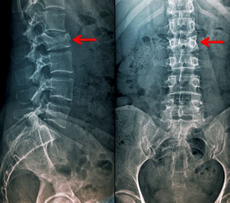 Back pain/ leg pain X-ray — Knotry